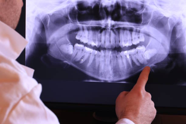 Best Emergency Denture Repair in York, SC