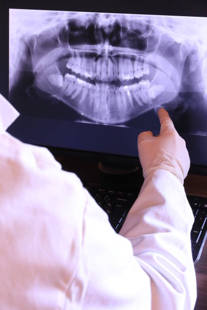 Best Broken or Chipped Tooth Repair in York, SC