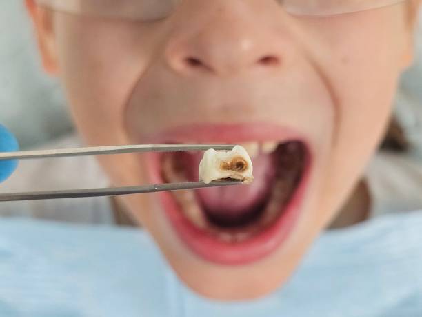 Best Emergency Pediatric Dental Care in York, SC